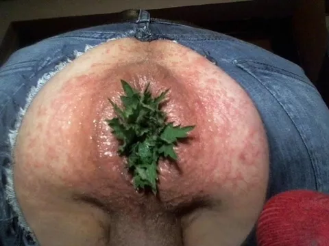 FFickBBare - BRENNNESSEL - NETTLE - ANAL